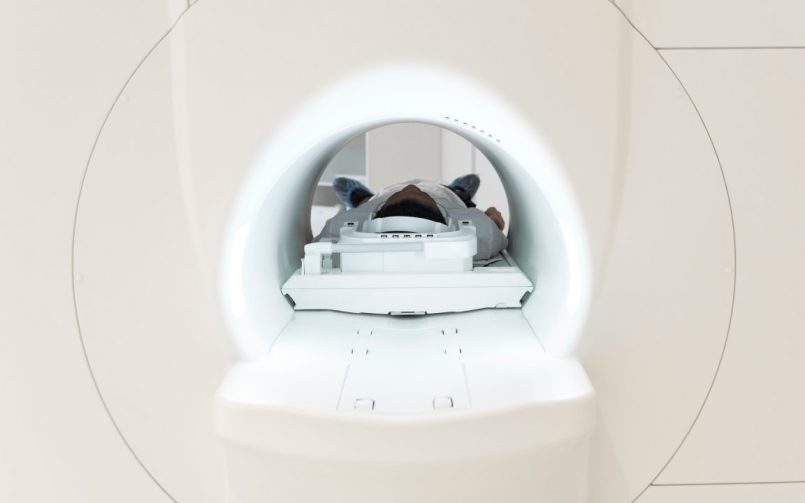 PET scan: o que é o exame e quando ele é indicado